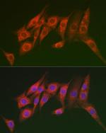 MTMR14 Antibody in Immunocytochemistry (ICC/IF)
