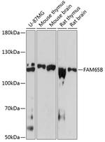 FAM65B Antibody in Western Blot (WB)