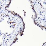 RGS14 Antibody in Immunohistochemistry (Paraffin) (IHC (P))