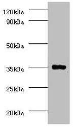PP2A beta Antibody in Western Blot (WB)