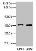 FOXR2 Antibody in Western Blot (WB)