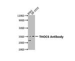 THOC6 Antibody in Western Blot (WB)