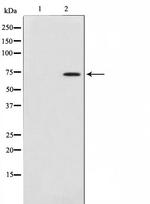 COL13A1 Antibody in Western Blot (WB)