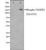 Phospho-VEGF Receptor 1 (Tyr1213) Antibody in Western Blot (WB)