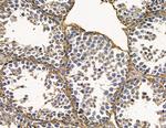 NFATC2IP Antibody in Immunohistochemistry (Paraffin) (IHC (P))