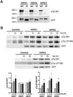 Phospho-HIPK2 (Tyr361) Antibody in Western Blot (WB)