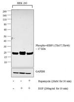 Phospho-4EBP1 (Thr37, Thr46) Antibody