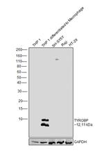TYROBP Antibody in Western Blot (WB)