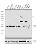 GNA11 Antibody in Western Blot (WB)