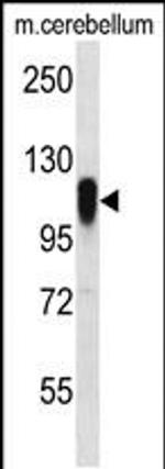 FBXO41 Antibody in Western Blot (WB)