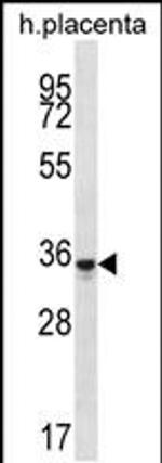OR6K6 Antibody in Western Blot (WB)