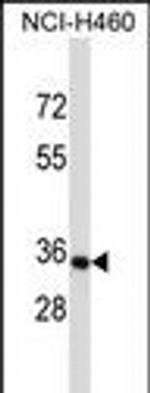 OR14C36 Antibody in Western Blot (WB)
