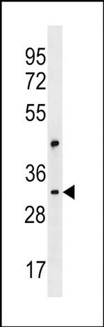 CEP170L Antibody in Western Blot (WB)