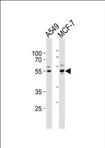 PPP2R2C Antibody in Western Blot (WB)