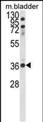 CCDC3 Antibody in Western Blot (WB)