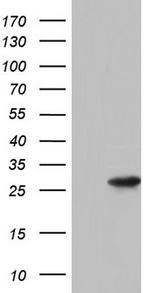 PAFAH1B3 Antibody in Western Blot (WB)