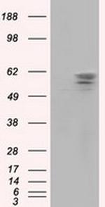 PANK2 Antibody in Western Blot (WB)