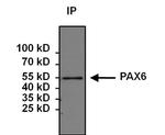 PAX6 Antibody in Immunoprecipitation (IP)
