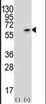 PCTAIRE3 Antibody in Western Blot (WB)