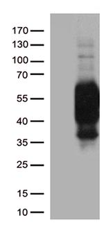 PDCD1 Antibody in Western Blot (WB)