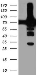 PFKP Antibody in Western Blot (WB)