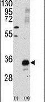 PIM1 Antibody in Western Blot (WB)