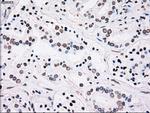 PLK1 Antibody in Immunohistochemistry (Paraffin) (IHC (P))