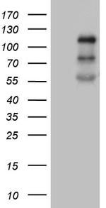 PLK4 Antibody in Western Blot (WB)