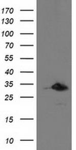 PNMT Antibody in Western Blot (WB)