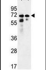 PNPLA8 Antibody in Western Blot (WB)