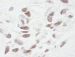PNUTS Antibody in Immunohistochemistry (IHC)