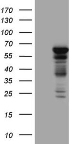 PPP2R1B Antibody in Western Blot (WB)
