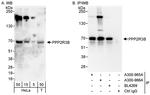 PPP2R3B Antibody in Western Blot (WB)