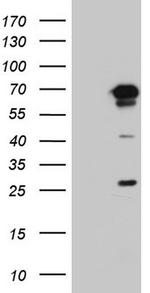 PPP2R5D Antibody in Western Blot (WB)