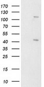 PRKAR1B Antibody in Western Blot (WB)