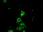 PRKAR2A Antibody in Immunocytochemistry (ICC/IF)