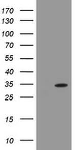 PROSC Antibody in Western Blot (WB)