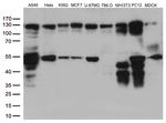 PTK2 Antibody in Western Blot (WB)
