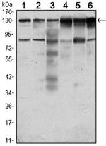 PTK7 Antibody in Western Blot (WB)