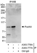 PanK4 Antibody in Immunoprecipitation (IP)