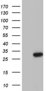 Patched1 Antibody in Western Blot (WB)