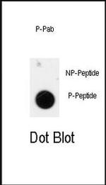 Phospho-TEM8 (Tyr425) Antibody in Dot Blot (DB)