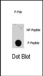 Phospho-E2F1 (Ser332) Antibody in Dot Blot (DB)
