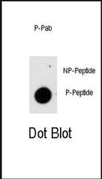 Phospho-GFAP (Ser8) Antibody in Dot Blot (DB)