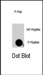 Phospho-HGK (Ser629) Antibody in Dot Blot (DB)