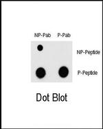 Phospho-MEF2C (Thr300) Antibody in Dot Blot (DB)