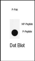 Phospho-Nanog (Ser285) Antibody in Dot Blot (DB)