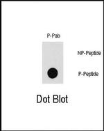 Phospho-PAK1 (Thr212) Antibody in Dot Blot (DB)