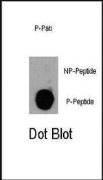 Phospho-PIK3CD (Tyr485) Antibody in Dot Blot (DB)