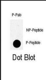 Phospho-TBK1 (Ser172) Antibody in Dot Blot (DB)